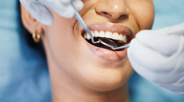 Best Emergency Treatment for Dental Infections or Abscesses in Fobes Hill, WA